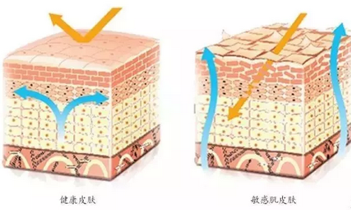 敏感肌膚與健康肌膚的對比，導(dǎo)致肌膚敏感的原因有哪些