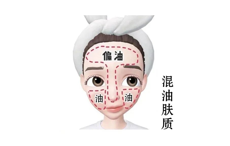 混合性皮膚如何護(hù)理效果好？