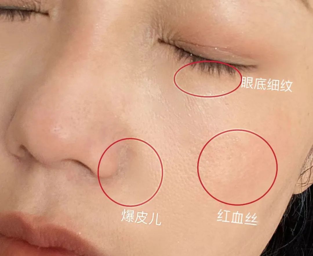 如何判斷自己是不是干敏肌膚？干敏肌有哪些特征？