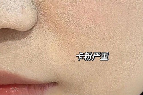 卡粉是什么意思？卡粉是什么原因引起的？