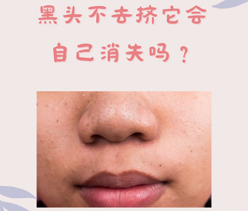 什么是黑頭？怎樣預防黑頭的形成？